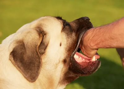 Dog Bit Attorney - Las Vegas